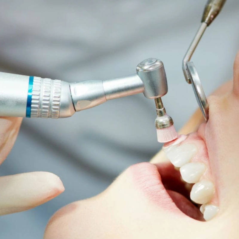 جرمگیری و بروساژ ایرفلو