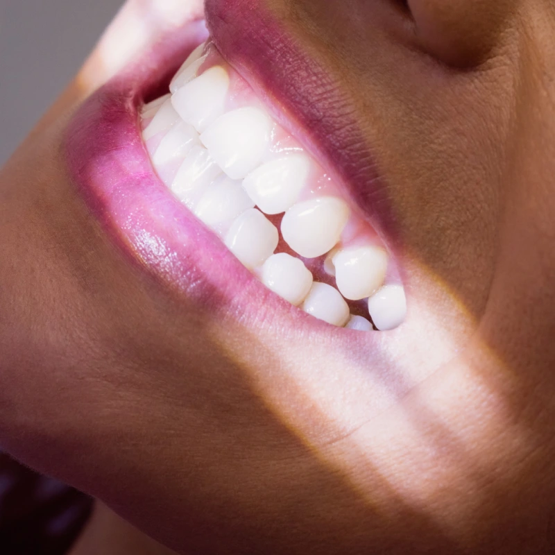 ونیر کامپوزیت