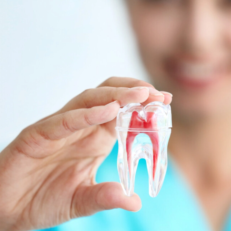 درمان ریشه دندان