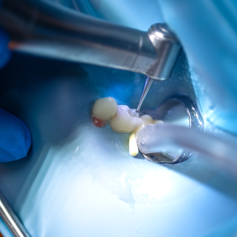 ترمیم دندان